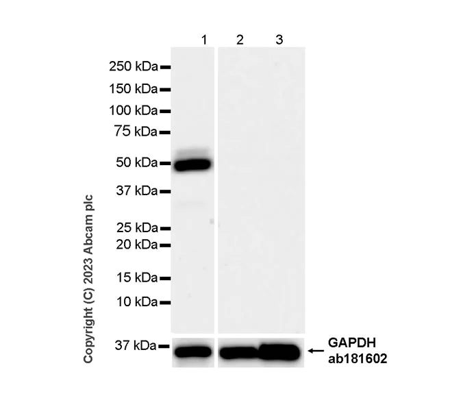 Western blot - Anti-RAGE antibody [RM1078] - BSA and Azide free (AB314774)