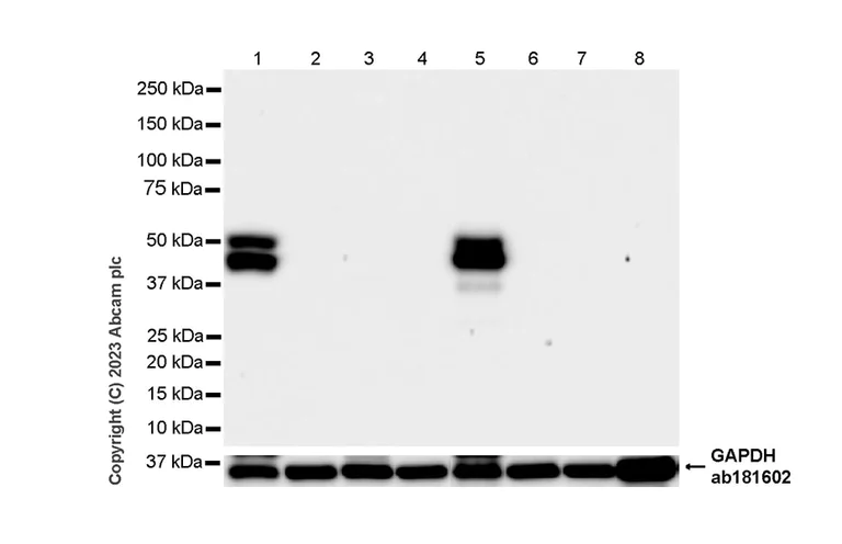Western blot - Anti-RAGE antibody [RM1078] - BSA and Azide free (AB314774)