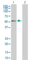 Western blot - RAGE overexpression 293T lysate (whole cell) (AB94079)