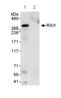 Immunoprecipitation - Anti-RAI1 antibody (AB86599)