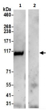 Immunoprecipitation - Anti-RAI14 antibody (AB241499)