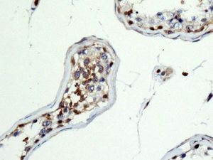 Immunohistochemistry (Formalin/PFA-fixed paraffin-embedded sections) - Anti-RAI14 antibody [EPR8518] (AB137118), expandable thumbnail