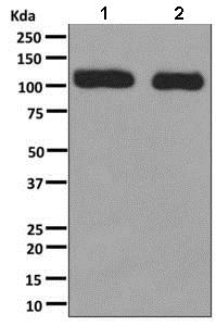Western blot - Anti-RAI14 antibody [EPR8518] (AB137118), expandable thumbnail