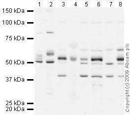Western blot - Raji whole cell lysate (AB30124)