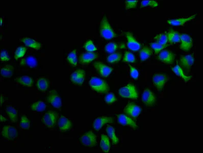 Immunocytochemistry/ Immunofluorescence - Anti-RALA antibody (AB236314)