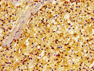 Immunohistochemistry (Formalin/PFA-fixed paraffin-embedded sections) - Anti-RALA antibody (AB236314), expandable thumbnail
