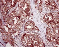 Immunohistochemistry (Formalin/PFA-fixed paraffin-embedded sections) - Anti-RALA antibody [EPR6468] (AB126627)