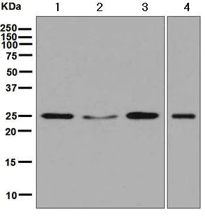 Western blot - Anti-RALA antibody [EPR6468] (AB126627)