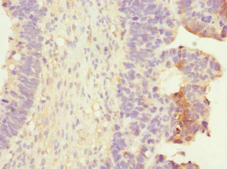 Immunohistochemistry (Formalin/PFA-fixed paraffin-embedded sections) - Anti-RALB antibody (AB223479)