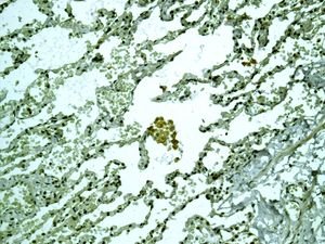 Immunohistochemistry (Formalin/PFA-fixed paraffin-embedded sections) - Anti-RALBP1 antibody [EPR6472] (AB133549), expandable thumbnail