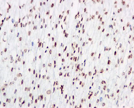 Immunohistochemistry (Formalin/PFA-fixed paraffin-embedded sections) - Anti-RALY antibody [EPR10121] (AB170105)