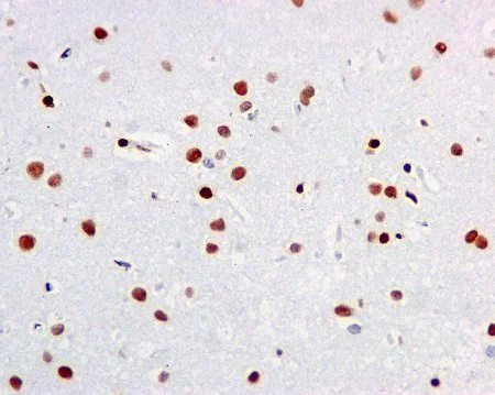 Immunohistochemistry (Formalin/PFA-fixed paraffin-embedded sections) - Anti-RALY antibody [EPR10121] (AB170105)