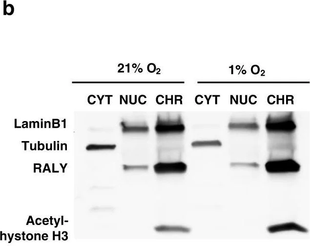 Western blot - Anti-RALY antibody [EPR10121] (AB170105)