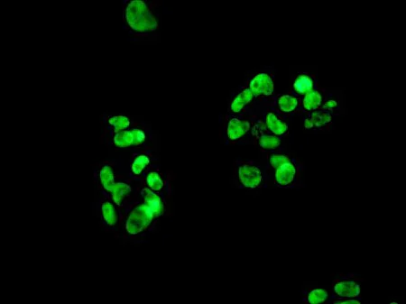 Immunocytochemistry/ Immunofluorescence - Anti-RALY antibody [EPR10121] - BSA and Azide free (AB249532)