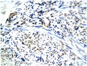 Immunohistochemistry (Formalin/PFA-fixed paraffin-embedded sections) - Anti-RAMP1 antibody (AB203282)