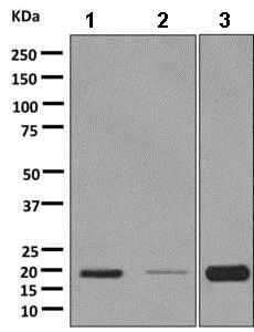 Western blot - Anti-RAMP1 antibody [EPR10867] (AB156575)