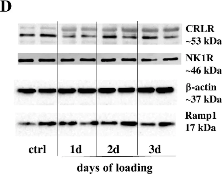 Western blot - Anti-RAMP1 antibody [EPR10867] (AB156575)