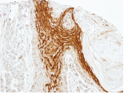 Immunohistochemistry (Formalin/PFA-fixed paraffin-embedded sections) - Anti-RAMP2 antibody (AB96546)
