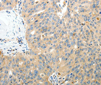 Immunohistochemistry (Formalin/PFA-fixed paraffin-embedded sections) - Anti-RAMP3 antibody (AB197372)