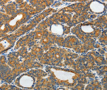 Immunohistochemistry (Formalin/PFA-fixed paraffin-embedded sections) - Anti-RAMP3 antibody (AB197372)