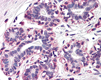 Immunohistochemistry (Formalin/PFA-fixed paraffin-embedded sections) - Anti-RAMP3 antibody (AB78017)