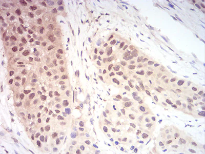 Immunohistochemistry (Formalin/PFA-fixed paraffin-embedded sections) - Anti-Ran antibody [8D1H12] (AB233762)