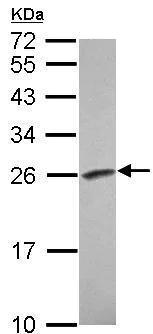 Western blot - Anti-Ran antibody (AB209725)