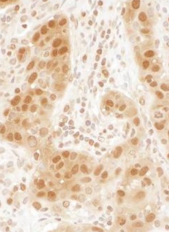 Immunohistochemistry (Formalin/PFA-fixed paraffin-embedded sections) - Anti-Ran antibody (AB226195)