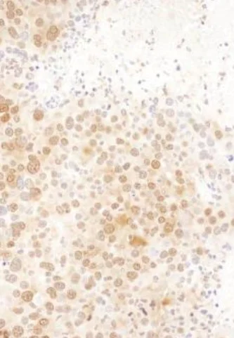 Immunohistochemistry (Formalin/PFA-fixed paraffin-embedded sections) - Anti-Ran antibody (AB226195)