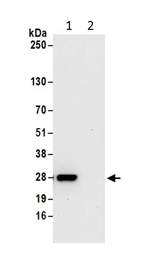Immunoprecipitation - Anti-Ran antibody (AB226195)