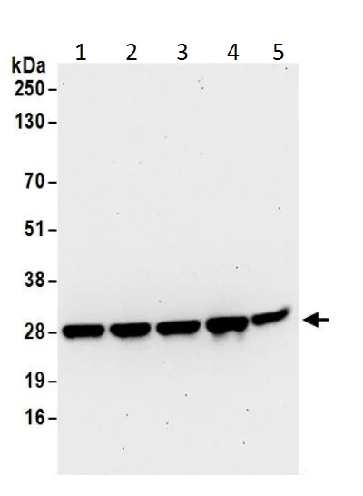 Western blot - Anti-Ran antibody (AB226195)