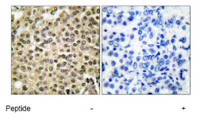 Immunohistochemistry (Formalin/PFA-fixed paraffin-embedded sections) - Anti-Ran antibody (AB53775)