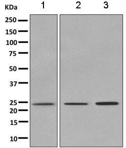 Western blot - Anti-Ran antibody [EPR10790(B)] (AB157213)