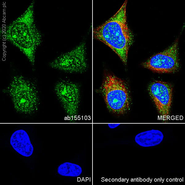 Immunocytochemistry/ Immunofluorescence - Anti-Ran antibody [EPR10791(B)] (AB155103)
