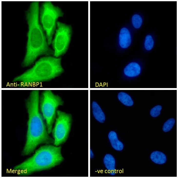 Immunocytochemistry/ Immunofluorescence - Anti-RanBP1 antibody (AB17034)