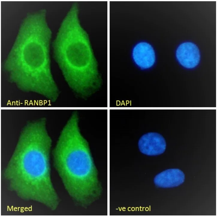 Immunocytochemistry/ Immunofluorescence - Anti-RanBP1 antibody (AB17034)