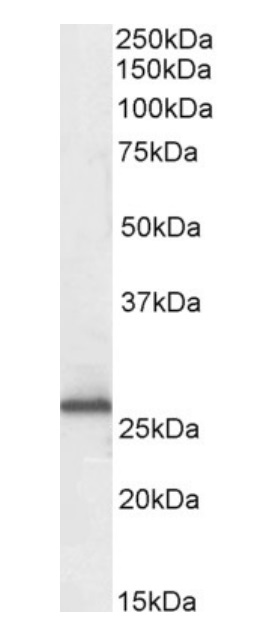Western blot - Anti-RanBP1 antibody (AB17034)