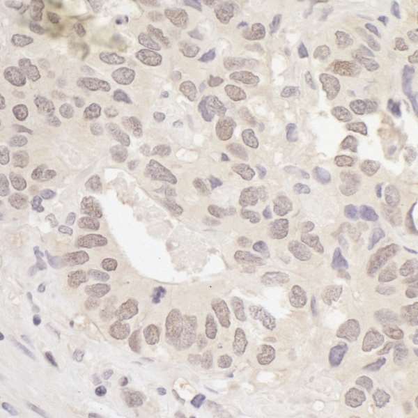 Immunohistochemistry (Formalin/PFA-fixed paraffin-embedded sections) - Anti-RanBP1 antibody (AB264129)