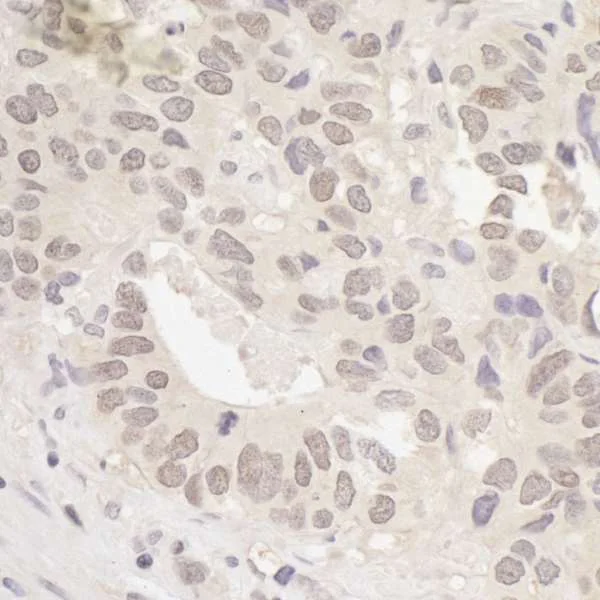 Immunohistochemistry (Formalin/PFA-fixed paraffin-embedded sections) - Anti-RanBP1 antibody (AB264129)