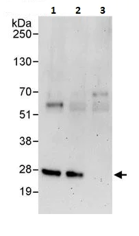 Immunoprecipitation - Anti-RanBP1 antibody (AB264129)
