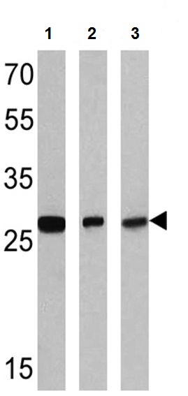 Western blot - Anti-RanBP1 antibody (AB2937)