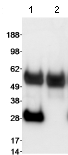 Immunoprecipitation - Anti-RanBP1 antibody (AB70185)