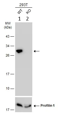 Western blot - Anti-RanBP1 antibody (AB97659)