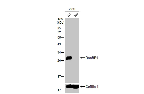 Western blot - Anti-RanBP1 antibody [HL2358] (AB317209)