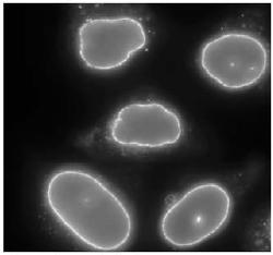 Immunocytochemistry/ Immunofluorescence - Anti-RanBP2 antibody (AB64276)