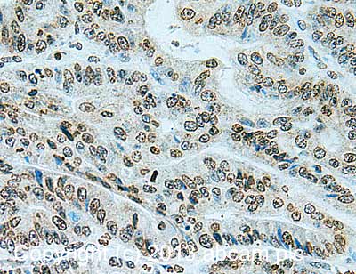 Immunohistochemistry (Formalin/PFA-fixed paraffin-embedded sections) - Anti-RanBP2 antibody [mAbcam58385] (AB58385)