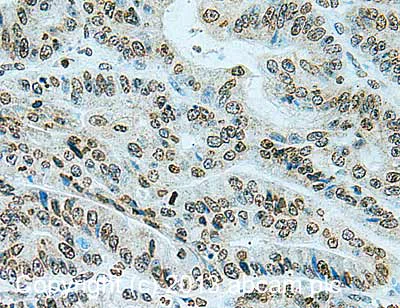 Immunohistochemistry (Formalin/PFA-fixed paraffin-embedded sections) - Anti-RanBP2 antibody [mAbcam58385] (AB58385)