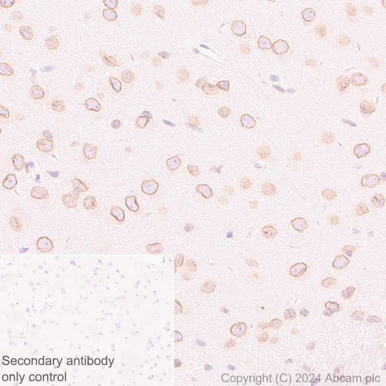 Immunohistochemistry (Formalin/PFA-fixed paraffin-embedded sections) - Anti-RanBP2 antibody [RM2047] - BSA and Azide free (AB316337)