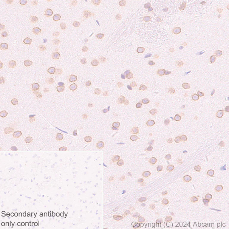 Immunohistochemistry (Formalin/PFA-fixed paraffin-embedded sections) - Anti-RanBP2 antibody [RM2047] - BSA and Azide free (AB316337)