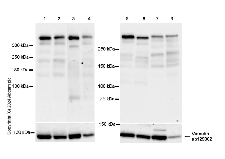 Western blot - Anti-RanBP2 antibody [RM2047] - BSA and Azide free (AB316337)